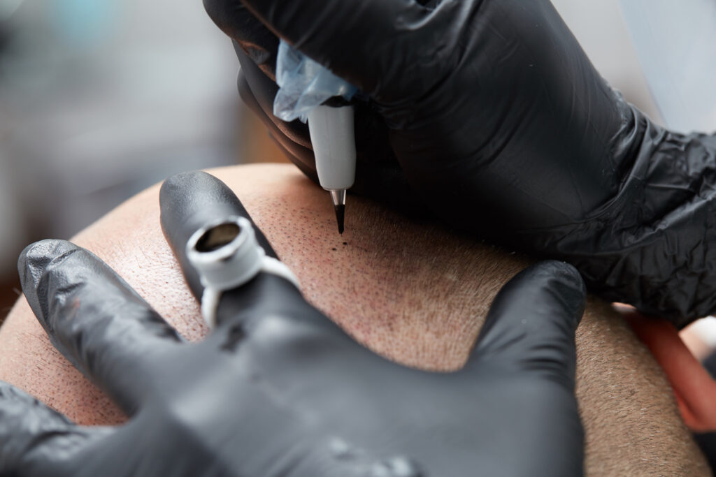 tricopigmentation