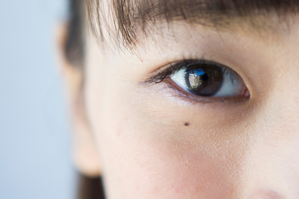 dermopigmentation grain de beauté oeil